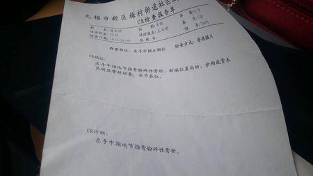 最新骨折伤残鉴定标准及其步骤指南