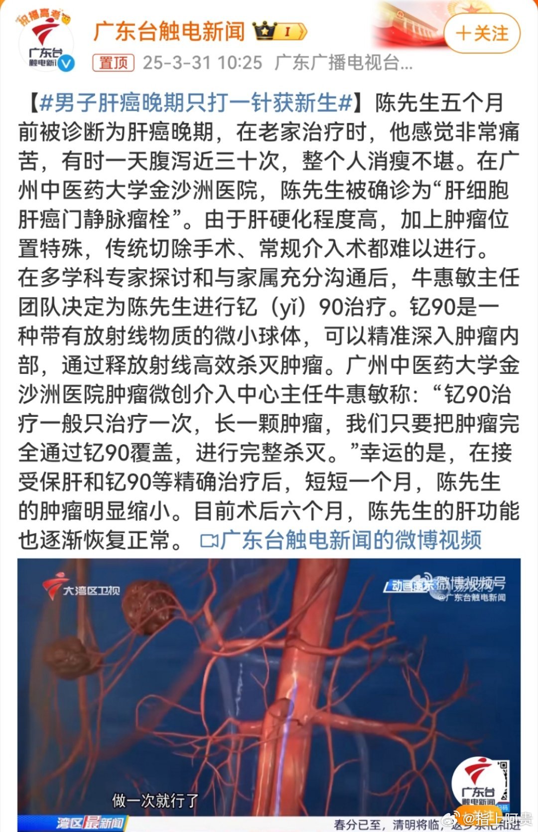 肝癌最新治疗方法研究及进展